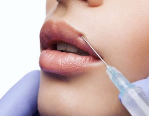 Injection Gel Dermal Filler Syringe Hyaluronic Acid